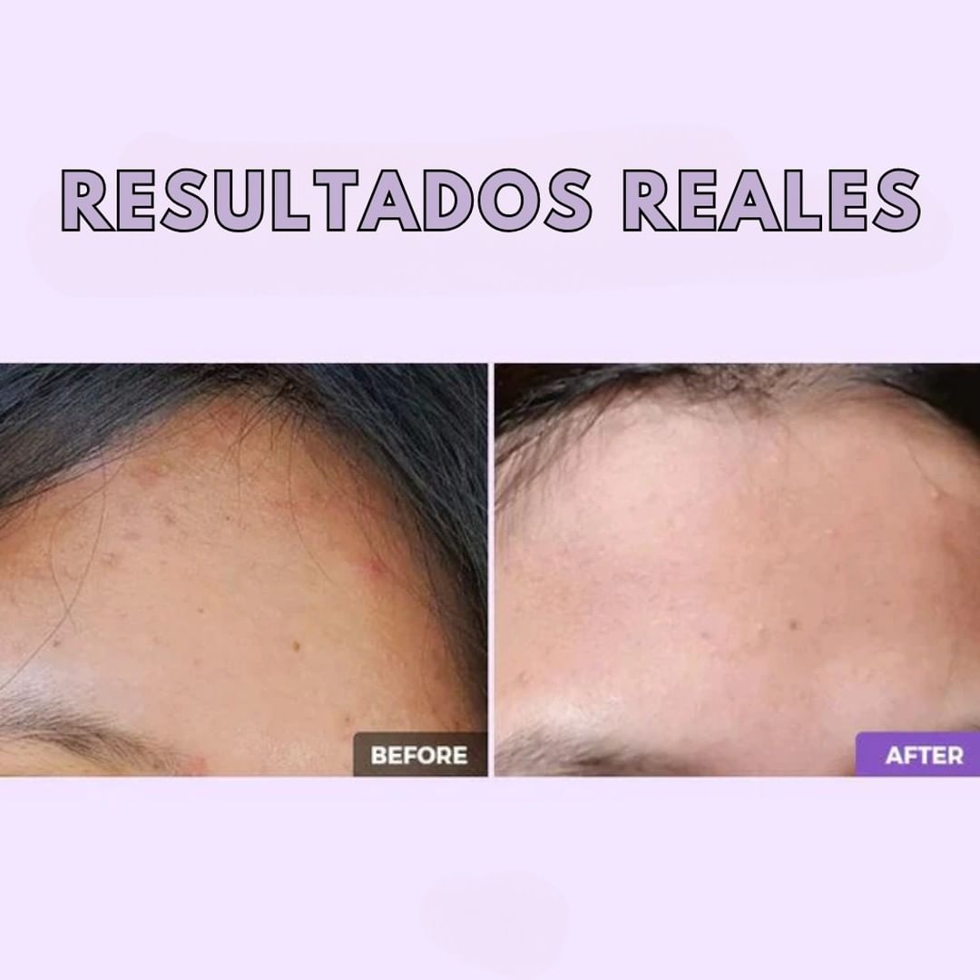 COSRX - AHABHA Clarifying Treatment Toner 150mL